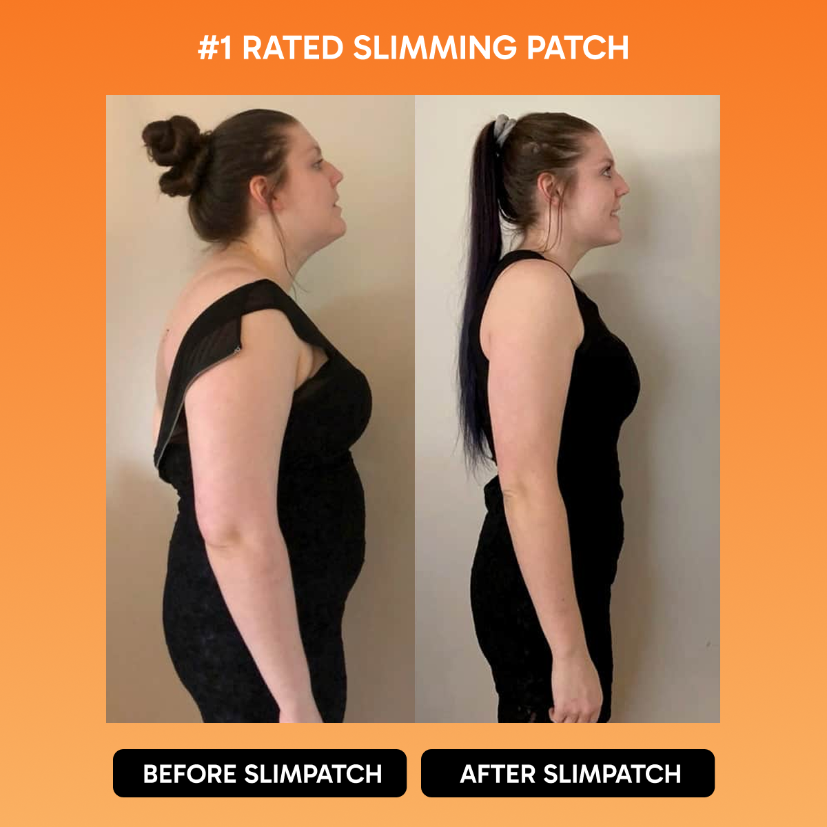 SlimPatch™