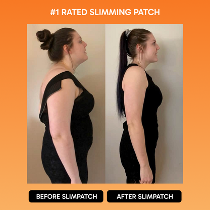 SlimPatch™